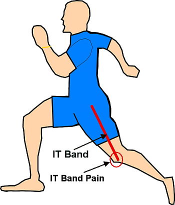 5 stretches to do before running to relieve pain from IT Band Syndrome -  Zamst Blog